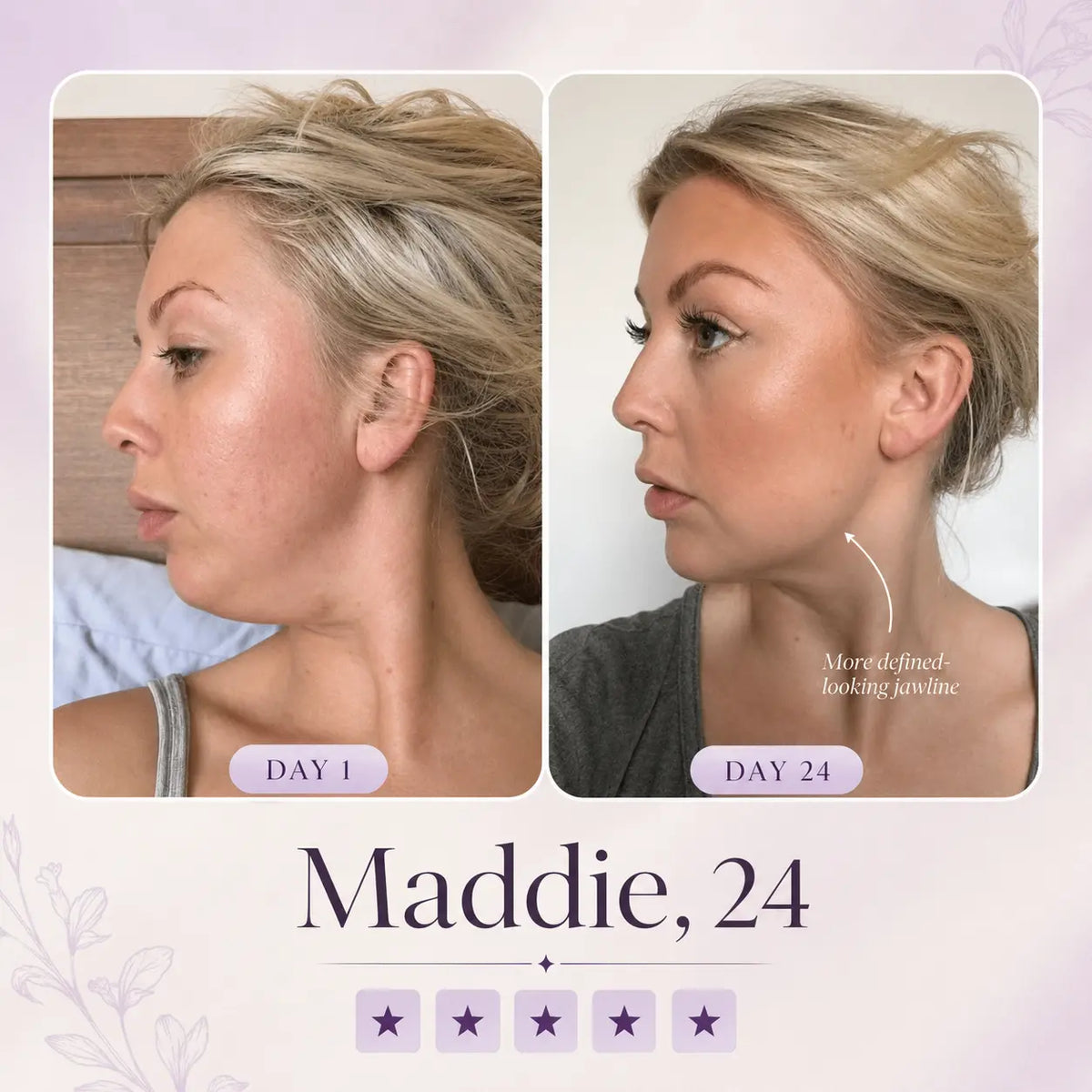 Sculptics Mask – Double Chin Lifting Mask