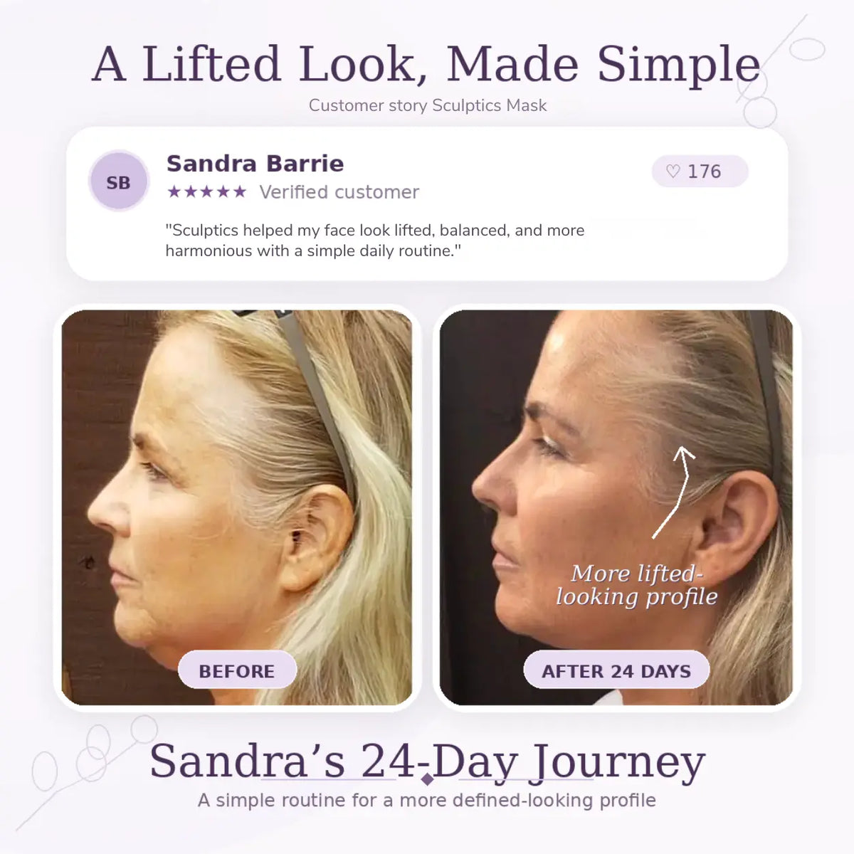 Sculptics Mask – Double Chin Lifting Mask