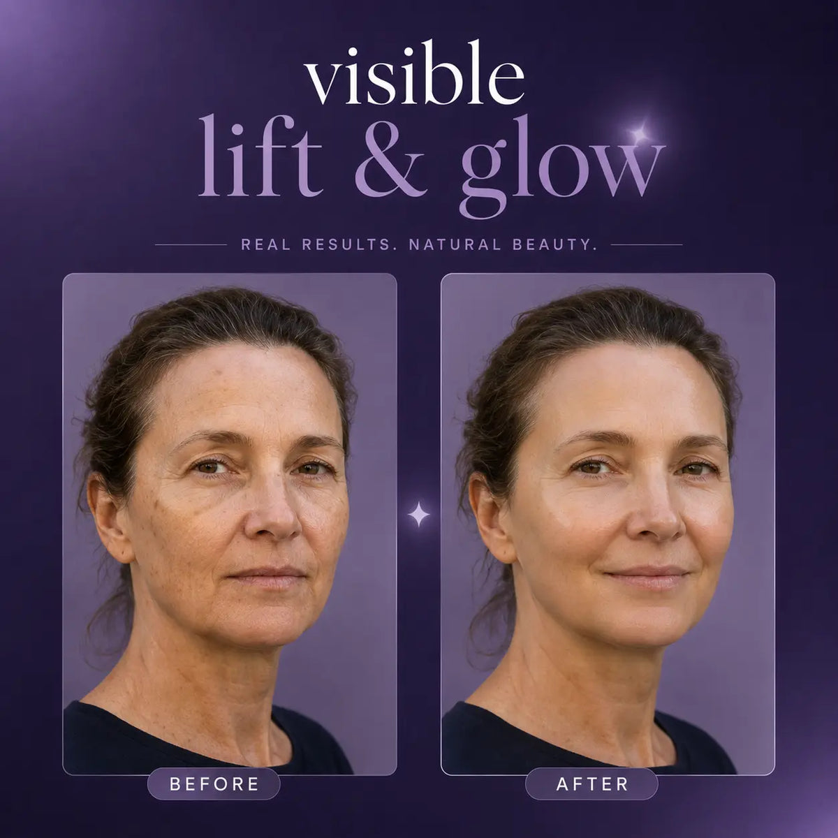 Facial Cupping Set – Lift, Depuff & Glow